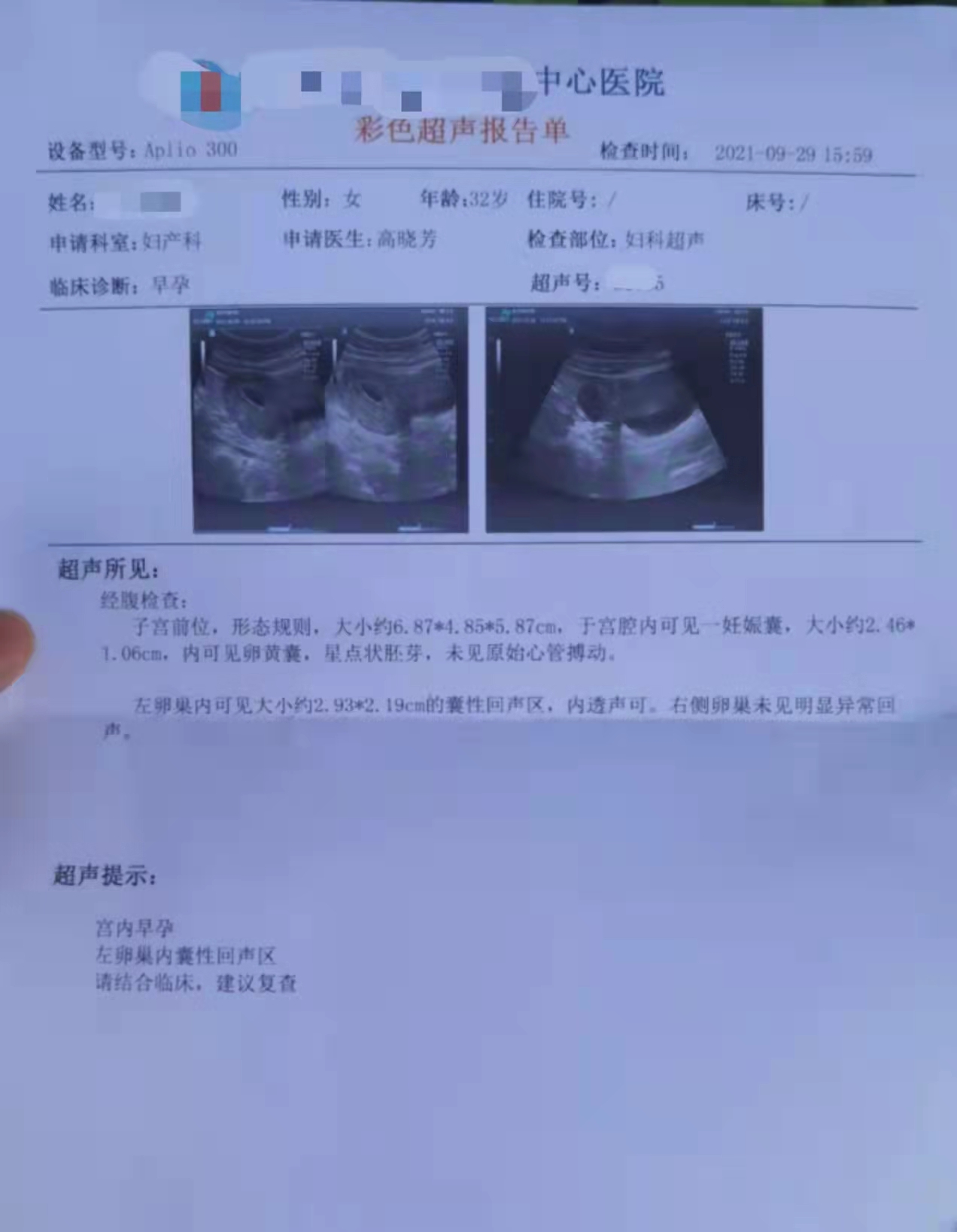 天津妇产医院孕检