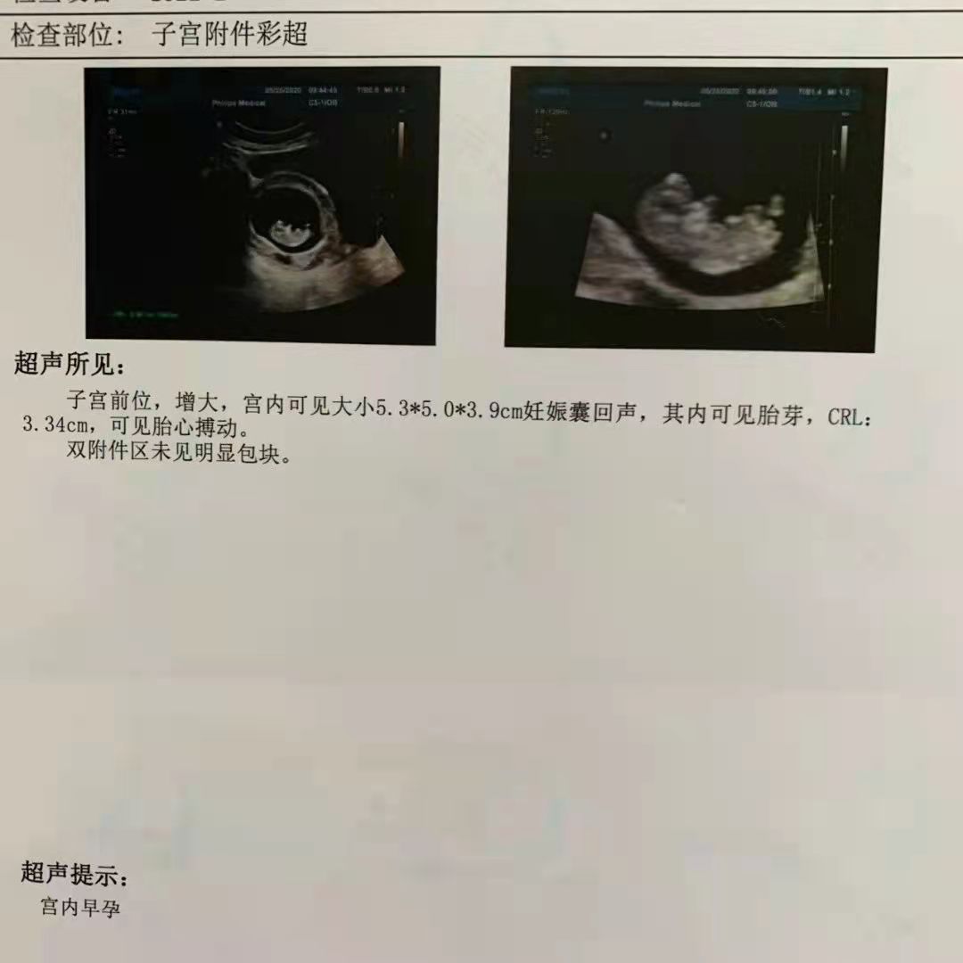 天津妇产孕检报告